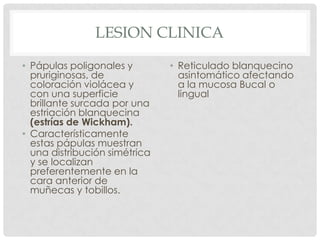 LESION CLINICA
• Pápulas poligonales y
pruriginosas, de
coloración violácea y
con una superficie
brillante surcada por una
estriación blanquecina
(estrías de Wickham).
• Característicamente
estas pápulas muestran
una distribución simétrica
y se localizan
preferentemente en la
cara anterior de
muñecas y tobillos.

• Reticulado blanquecino
asintomático afectando
a la mucosa Bucal o
lingual

 