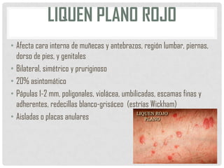 LIQUEN PLANO ROJO
• Afecta cara interna de muñecas y antebrazos, región lumbar, piernas,
dorso de pies, y genitales
• Bilateral, simétrico y pruriginoso
• 20% asintomático
• Pápulas 1-2 mm, poligonales, violácea, umbilicadas, escamas finas y
adherentes, redecillas blanco-grisáceo (estrías Wickham)
• Aisladas o placas anulares

 