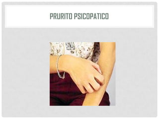 PRURITO PSICOPATICO

 