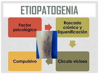 ETIOPATOGENIA
Factor
psicológico

Rascado
crónico y
liquenificación

Compulsivo

Círculo vicioso

 
