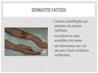 DERMATITIS FACTICIA
• Lesiones autoinflingidas por
pacientes con psicosis
manifiesta
• se localizan en zonas
accesibles a las manos
• son ulceraciones con o sin
necrosis y hasta verdaderas
mutilaciones.

 