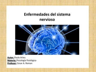Autor: Paulo Arieu
Materia: Psicología fisiológica
Profesor: Cesar A. Roman
Enfermedades del sistema
nervioso
 