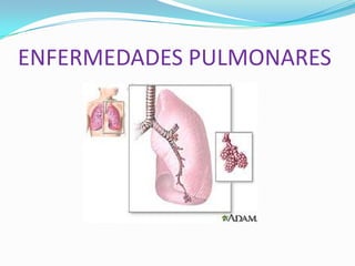 ENFERMEDADES PULMONARES
 