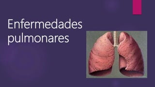 Enfermedades
pulmonares
 