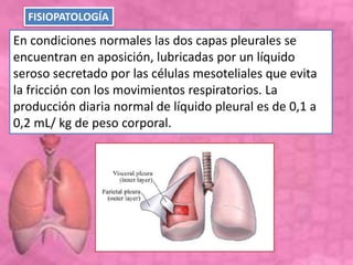 En condiciones normales las dos capas pleurales se
encuentran en aposición, lubricadas por un líquido
seroso secretado por las células mesoteliales que evita
la fricción con los movimientos respiratorios. La
producción diaria normal de líquido pleural es de 0,1 a
0,2 mL/ kg de peso corporal.
FISIOPATOLOGÍA
 