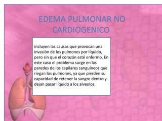 EDEMA PULMONAR NO
CARDIOGENICO
incluyen las causas que provocan una
invasión de los pulmones por líquido,
pero sin que el corazón esté enfermo. En
este caso el problema surge en las
paredes de los capilares sanguíneos que
riegan los pulmones, ya que pierden su
capacidad de retener la sangre dentro y
dejan pasar líquido a los alveolos.
 