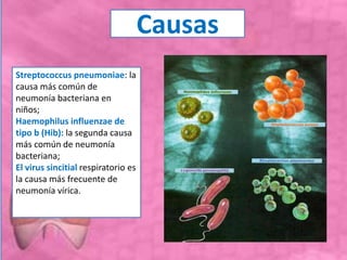 Causas
Streptococcus pneumoniae: la
causa más común de
neumonía bacteriana en
niños;
Haemophilus influenzae de
tipo b (Hib): la segunda causa
más común de neumonía
bacteriana;
El virus sincitial respiratorio es
la causa más frecuente de
neumonía vírica.
 