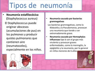 • Neumonía estafilocócica
(Staphylococcus aureus)
El Staphylococcus puede
originar abscesos
(acumulaciones de pus) en
los pulmones y producir
quistes pulmonares que
contienen aire
(neumatoceles),
especialmente en los niños.
Tipos de neumonía
• Neumonía causada por bacterias
gramnegativas
Las bacterias gramnegativas, como la
Klebsiella y la Pseudomonas, provocan
una neumonía que tiende a ser
extremadamente grave.
• Neumonía causada por Hemophylus
influenzae tipo b son el grupo más
virulento y provocan graves
enfermedades, como la meningitis, la
epiglotitis y la neumonía, por lo general
en niños menores de 6 años.
 