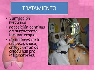 TRATAMIENTO
• Ventilación
mecánica
• reposición continua
de surfactante,
inmunoterapia,
• inhibidores de la
ciclooxigenasa,
antagonistas de
citoquinas pro
inflamatorias,
 