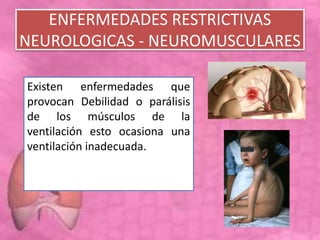 ENFERMEDADES RESTRICTIVAS
NEUROLOGICAS - NEUROMUSCULARES
Existen enfermedades que
provocan Debilidad o parálisis
de los músculos de la
ventilación esto ocasiona una
ventilación inadecuada.
 