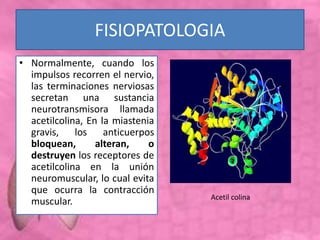 FISIOPATOLOGIA
• Normalmente, cuando los
impulsos recorren el nervio,
las terminaciones nerviosas
secretan una sustancia
neurotransmisora llamada
acetilcolina, En la miastenia
gravis, los anticuerpos
bloquean, alteran, o
destruyen los receptores de
acetilcolina en la unión
neuromuscular, lo cual evita
que ocurra la contracción
muscular. Acetil colina
 