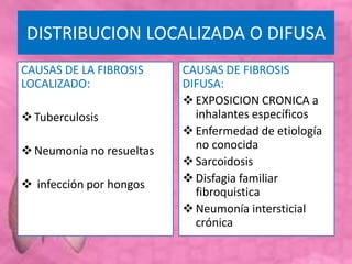 DISTRIBUCION LOCALIZADA O DIFUSA
CAUSAS DE LA FIBROSIS
LOCALIZADO:
Tuberculosis
Neumonía no resueltas
 infección por hongos
CAUSAS DE FIBROSIS
DIFUSA:
EXPOSICION CRONICA a
inhalantes específicos
Enfermedad de etiología
no conocida
Sarcoidosis
Disfagia familiar
fibroquistica
Neumonía intersticial
crónica
 