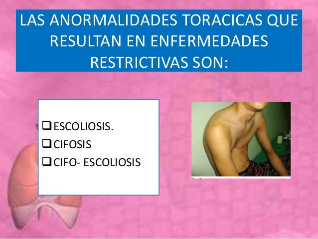 Los dolores en la nuca y el cuello a la osteocondrosis el tratamiento