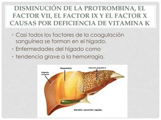 DISMINUCIÓN DE LA PROTROMBINA, EL
FACTOR VII, EL FACTOR IX Y EL FACTOR X
CAUSAS POR DEFICIENCIA DE VITAMINA K
• Casi todos los factores de la coagulación
sanguínea se forman en el hígado.
• Enfermedades del hígado como
• tendencia grave a la hemorragia.
 