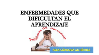 ENFERMEDADES QUE 
DIFICULTAN EL 
APRENDIZAJE 
ALEX CÓRDOVA GUTIÉRREZ 
 