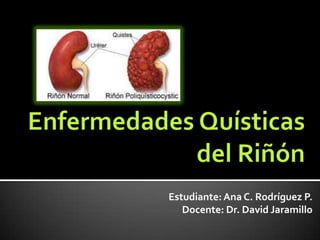 Estudiante: Ana C. Rodríguez P.
   Docente: Dr. David Jaramillo
 