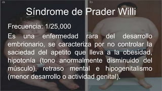 Síndrome de Prader Willi
Frecuencia: 1/25,000
Es una enfermedad rara del desarrollo
embrionario, se caracteriza por no controlar la
saciedad del apetito que lleva a la obesidad,
hipotonía (tono anormalmente disminuido del
músculo), retraso mental e hipogenitalismo
(menor desarrollo o actividad genital).
 