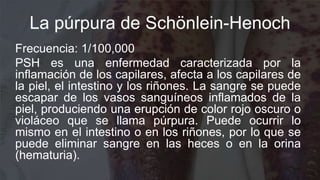 La púrpura de Schönlein-Henoch
Frecuencia: 1/100,000
PSH es una enfermedad caracterizada por la
inflamación de los capilares, afecta a los capilares de
la piel, el intestino y los riñones. La sangre se puede
escapar de los vasos sanguíneos inflamados de la
piel, produciendo una erupción de color rojo oscuro o
violáceo que se llama púrpura. Puede ocurrir lo
mismo en el intestino o en los riñones, por lo que se
puede eliminar sangre en las heces o en la orina
(hematuria).
 