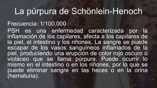 La púrpura de Schönlein-Henoch
Frecuencia: 1/100,000
PSH es una enfermedad caracterizada por la
inflamación de los capilar...