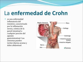 La  enfermedad de Crohn es una enfermedad inflamatoria del intestino, caracterizada por la inflamación severa, crónica de la pared intestinal o cualquier porción del aparato gastrointestinal. Los síntomas pueden incluir diarrea acuosa y dolor abdominal. 