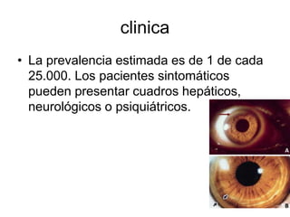 clinica
• La prevalencia estimada es de 1 de cada
25.000. Los pacientes sintomáticos
pueden presentar cuadros hepáticos,
neurológicos o psiquiátricos.

 