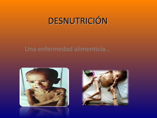 DESNUTRICIÓNDESNUTRICIÓN
Una enfermedad alimenticia…
 
