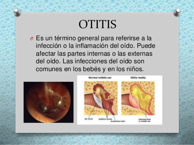 Enfermedades respiratorias