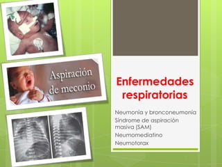 Enfermedades
respiratorias
Neumonía y bronconeumonía
Síndrome de aspiración
masiva (SAM)
Neumomediatino
Neumotorax
 
