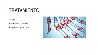 TRATAMIENTO 
AINES 
Corticoesteroides 
Inmunosupresoras 
 
