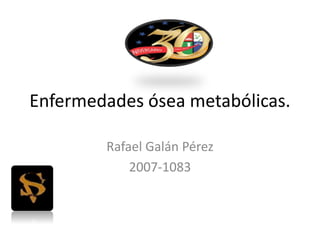 Enfermedades ósea metabólicas.
Rafael Galán Pérez
2007-1083
 