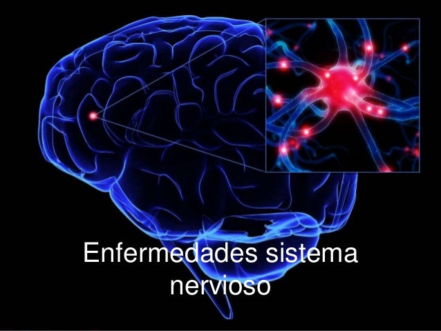 Enfermedades Sistema Nervioso