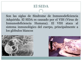 El SIDA	Son las siglas de Síndrome de Inmunodeficiencia Adquirida. El SIDA es causado por el VIH (Virus de Inmunodeficiencia Humana). El VIH ataca al sistema inmunológico del cuerpo, principalmente a los glóbulos blancos