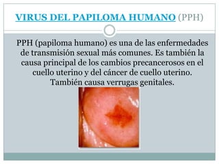 VIRUS DEL PAPILOMA HUMANO (PPH)	PPH (papiloma humano) es una de las enfermedades de transmisión sexual más comunes. Es también la causa principal de los cambios precancerosos en el cuello uterino y del cáncer de cuello uterino. También causa verrugas genitales.