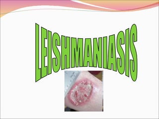 LEISHMANIASIS 