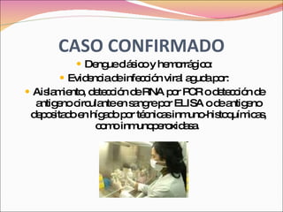CASO CONFIRMADO Dengue clásico y hemorrágico: Evidencia de infección viral aguda por: Aislamiento, detección de RNA por PCR o detección de antigeno circulante en sangre por ELISA o de antigeno depositado en hígado por técnicas inmuno-histoquímicas, como inmunoperoxidasa.  