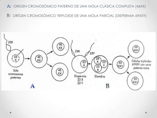 ORIGEN CROMOSÓMICO PATERNO DE UNA MOLA CLÁSICA COMPLETA (46XX)

ORÍGEN CROMOSÓMICO TRIPLOIDE DE UNA MOLA PARCIAL (DISPERMIA 69XXY)
 