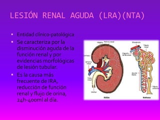 Enfermedades tubulares e intersticiales