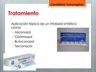 Tratamiento 
Aplicación tópica de un imidazol sintético 
como: 
 Miconazol 
 Clotrimazol 
 Butoconazol 
 Terconacol 
Candidiasis Vulvovaginal 
 