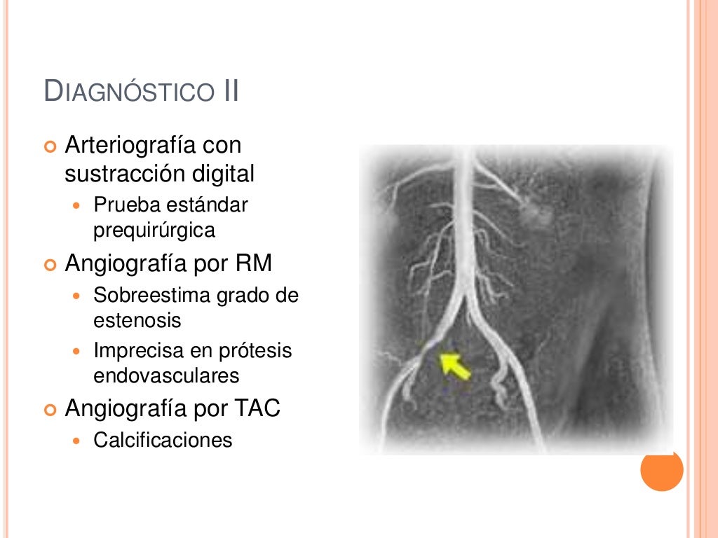 Enfermedades vasculares