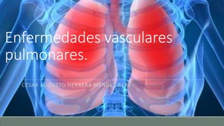 Enfermedades vasculares
pulmonares.
CÉSAR AUGUSTO HERRERA MÉNDEZ R1RX.
 