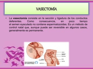 VASECTOMÍA 
• La vasectomía consiste en la sección y ligadura de los conductos 
deferentes. Como consecuencia, en poco tiempo 
el semen eyaculado no contiene espermatozoides. Es un método de 
control natal que, aunque puede ser reversible en algunos casos, 
generalmente es permanente. 
 
