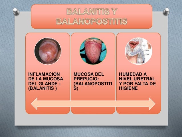 La foto de la psoriasis en la fase temprana sobre la cabeza