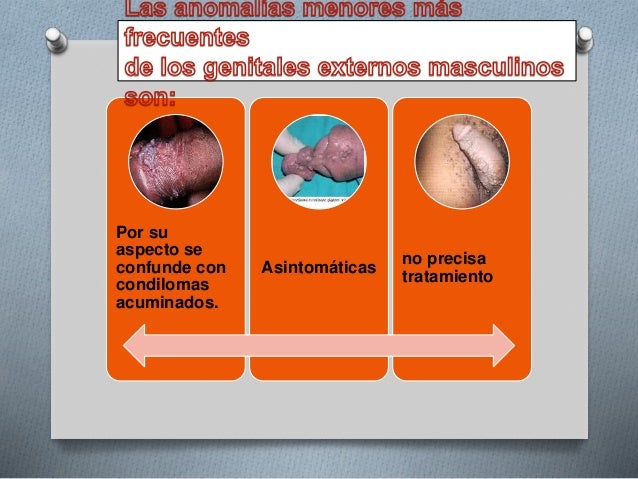 Enfermedades venereas del pene