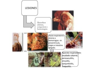 LESIONES
Describen
edemas,
congestion y
hemorragias.
Tracto respiratorio:
ulceras y
hemorragias en
proventrículo,
ciegos e intestino
delgado.
Aparato respiratorio:
exudado catarral,
aerosaculitis,
sinusitis,
conjuntivitis,
traqueítis.
 