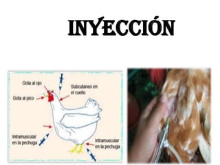 Inyección
 