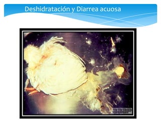 Deshidratación y Diarrea acuosa
 