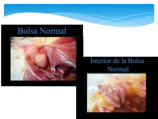 Bolsa Normal
Interior de la Bolsa
Normal
 