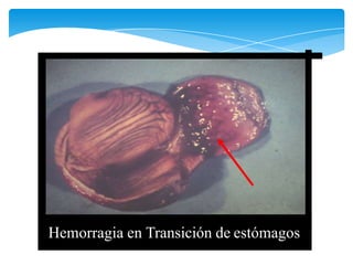 Hemorragia en Transición de estómagos
 