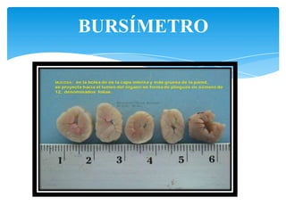 BURSÍMETRO
 