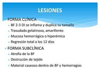 FORMA CLÍNICA
BF 2-3 DI se inflama y duplica su tamaño
Trasudado gelatinoso, amarillento
Mucosa hemorrágica o hiperémica
Regresión total a los 12 días
FORMA SUBCLÍNICA
Atrofia de la BF
Destrución de tejido
Material caseoso dentro de BF y hemorragias
LESIONES
 